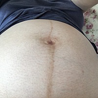 这是怀孕39周时肚子的照片，完全没有妊娠纹哦，宝宝生下来也是白白净净的，皮肤超级好