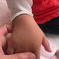 宝宝手上特别痒怎么办