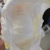 宝妈们有没有遇到过这种情况，三个月的小女孩