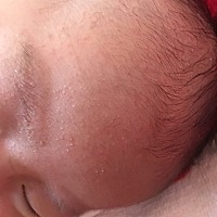 各位宝妈请问这是湿疹还是热疹？最近额头上起了好多，连头上都是的。
