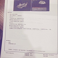 我是宝爸一枚，请我16周下面的数据正常吗？可以看出来是龙凤胎还是双胞胎男女