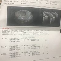这是月经干净的第三天30号做的卵泡监测 明天4号再去监测 看内膜有没有增厚 再打促排针 我希望 我祈祷能...