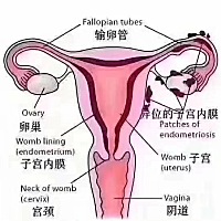 卵巢保养吃什么好？ 　　卵巢位于子宫底的后外侧，与盆腔侧壁相接，表面布满血管，内部含有黄色的卵泡，...