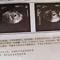 怀孕6周＋B超可以看出宝宝性别吗？