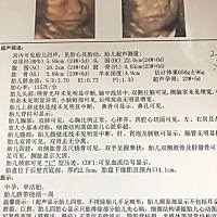 按月经末次时间来算 现在是24周+6 今天去检查四维显示孕周23周+5 按哪个算准确一些 23周脐带绕颈一周危...