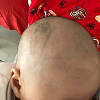 我家娃2个月了，剪掉胎毛怎么有一个兔耳朵的筋？