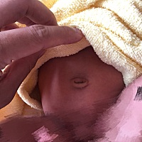 拜托🙏帮忙看看，宝宝这肚脐算正常吗？这生了以后也是各种玻璃心