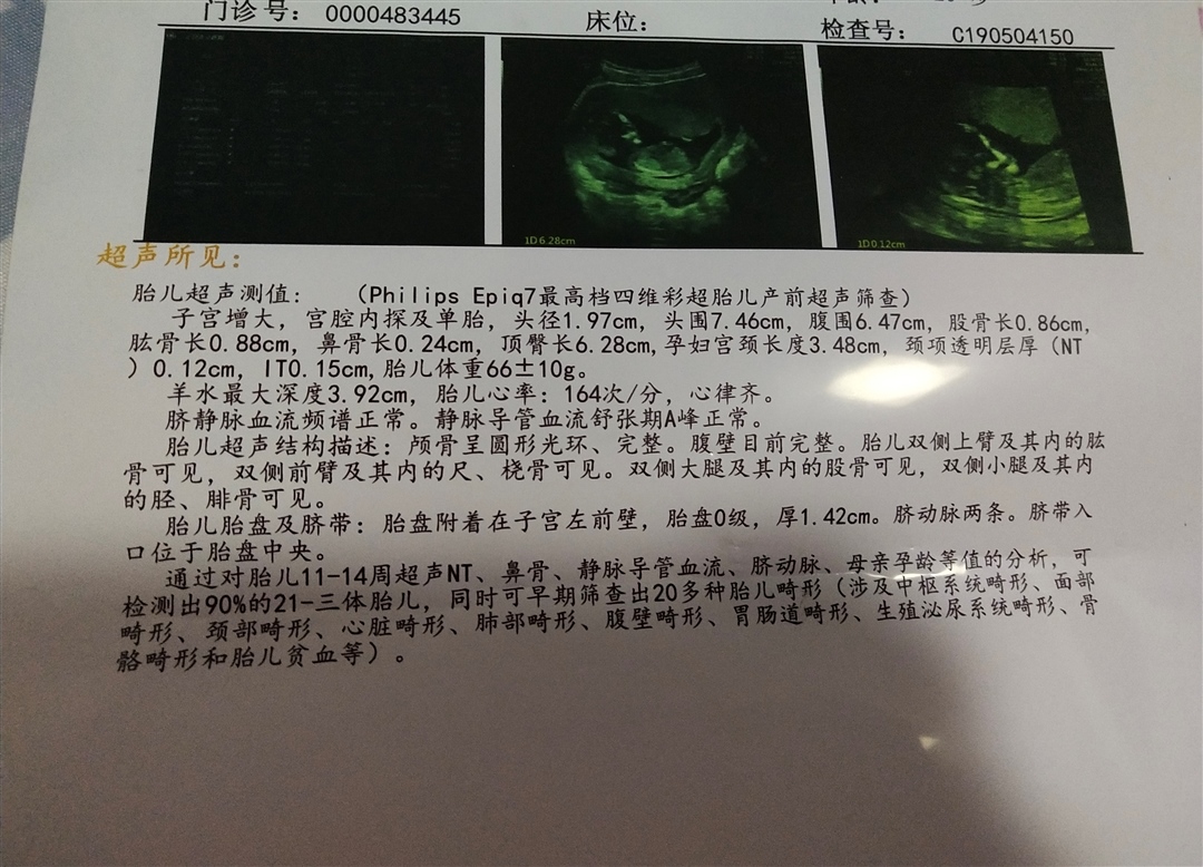 胎心比较高哦 正常的吗