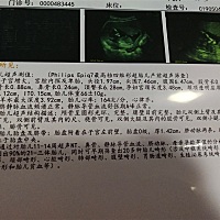 有宝妈会看男孩女孩的吗，纯属好奇而已 胎心比较高哦 正常的吗