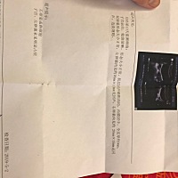 5月2号右侧卵泡20✖️15, 5月4号怎么变成19✖️14了 请问是排卵了还是萎缩了呢