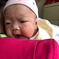 宝妈们，我想问哈宝宝脸上这个是什么东东……需要去买药擦吗？之前都还没有，这几天越冒越多了……看着...