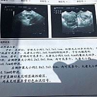 4月26月经第九天测排卵，会看的亲帮忙看看，是不是多囊卵巢