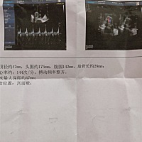 有谁能看出是男是女吗？19周