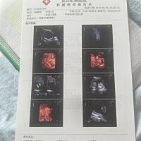 有没有孕妈可以帮帮我看看，今天做了四维彩超，说左心室有一枚强光点怎么办