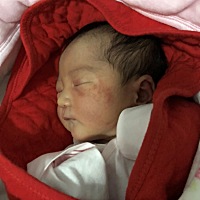 宝贝今天出生第二天 脸上和脖子里起的这是什么东西啊？让护士看的说是过敏  一会有一会没有 需不需要抹...