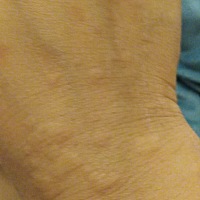 这个是什么东西呢，越挠越痒