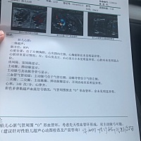 宝宝心脏彩超查出来o形血管环，双主动脉弓，还能要吗？有没有类似的宝宝，已经出生的