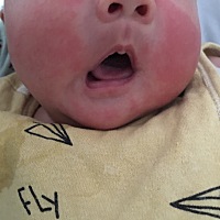 宝宝脸上红红的一块是什么，带有一粒一粒的