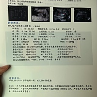 大家帮忙看看，四维数据正常吗？绕颈一周会不会有什么影响？好奇是男宝还是女宝