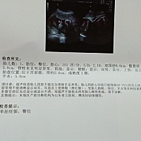 32周，佩琪还是乔治呢