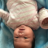 满月宝宝左右来回睡、是不是把头两侧睡扁了……太阳穴凹陷......怎么办啊……