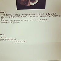 我怀孕7周3天第一次做检查，如图这样。各位孕妈你们有遇到这种事吗？求解