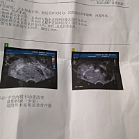 宫颈又有毛病了，真是心碎
