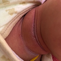 谁知道这样了怎么办，第一次当妈，不懂