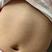 宝宝这几天长小痘痘的东西是怎么回事？