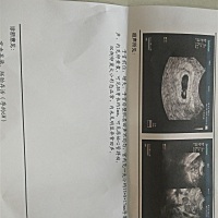 明天就出结果了，跪求如愿，跪求男宝，跪求菩萨保佑