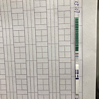 有灰色浅印，这是有了吗