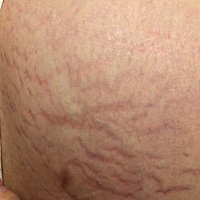 有没有妈妈的肚子比我难看的？......每个女孩子都爱美，我也超想拍孕期大肚照。无奈孕期非常显怀，肚子...