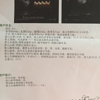 有孕妈会看男女吗？超过预产期了过几天要住院了