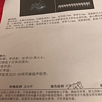 这个能看得出来男女吗？