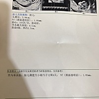 今天做的NT、有谁懂得看检查单的、能帮我看一下吗？一切是不是正常的？谢谢🙏