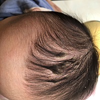 有没有什么好的办法把头上这个弄掉