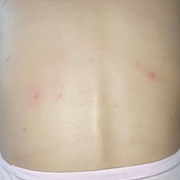 这个是长的什么怀孕了