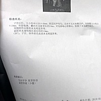 求大家帮我看看是男宝还是女宝
