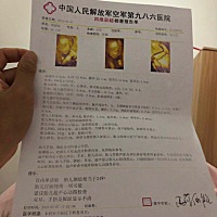 孕24周做的四维，一切正常，大家帮忙看看是男是女