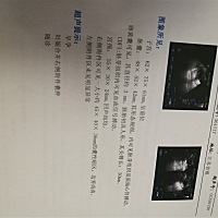 有哪位宝妈可以看看这是多少周的。