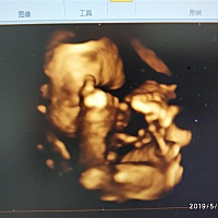 5D我是看不出来男女