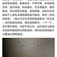 有没有孕妈 也长了这个的 百度了一下说是这个毛病