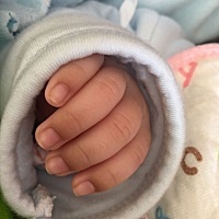 有哪位朋友知道宝宝手指头这是怎么了