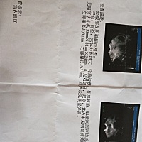 四月初测出怀孕，做了彩超啥都没有，五月七号测的彩超就是这个样子，暗区是啥意思有人知道么？是胎囊么...