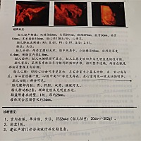 姐妹们帮忙看看是乔治还是佩奇👀