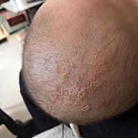 宝宝头上长的是什么呀