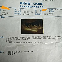 怀孕三个月零一天，5月1日做的检查 做了彩超 末次月经2.16  有没有准妈妈和我同一天的