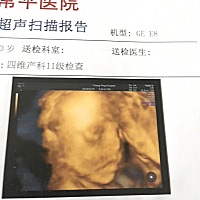 洗了个澡澡  突然发现变好看了 跟他四维时候拍的照片长得蛮像的 感觉自己也要变成炫娃狂魔了 哈哈哈哈哈