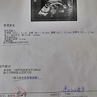 今天十八周 1检查胎儿双侧脉络丛回声欠均，怕怕的，有同样的宝妈吗？