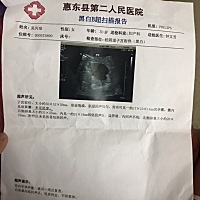 各位宝妈看看我这是什么情况、怀孕41天了孕酮从34.77掉到17.050没有发现胎心胎芽 这是今天的B超 这是27...